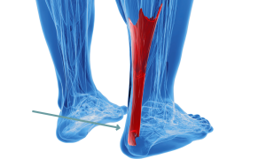 Если мучает боль в ноге выше пятки сзади – причины и способы лечения